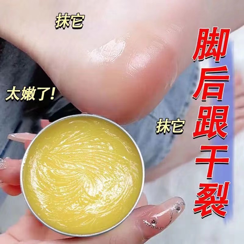 【拍一发三】 脚跟干裂冻裂膏皴裂膏摸手油干燥皴裂膏dd 到手价¥9.99