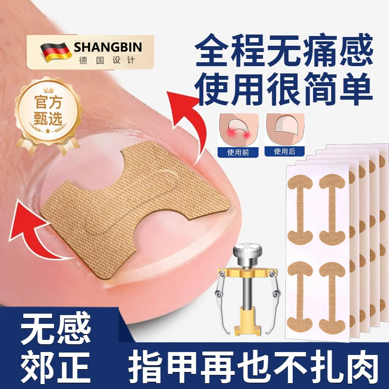 脚趾甲沟矫正器炎嵌甲专用指甲填充垫片脚指甲往肉里长纠正甲贴片 到手价¥5.80